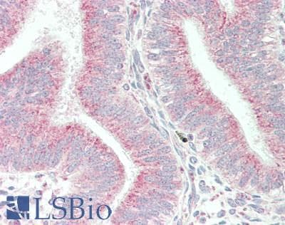 IHC-plus™ DVL2 / Dishevelled 2 Antibody (aa650-700)