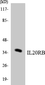 IL20RB Antibody (aa116-165)