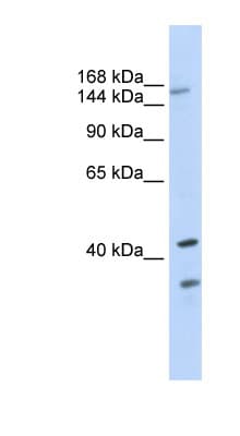 ABCC8 / SUR1 Antibody (N-Terminus)