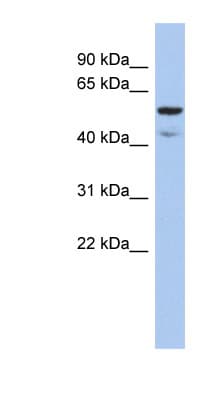 ATE1 Antibody (aa71-120)