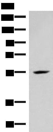 Polyclonal Rabbit anti-Human IRX4 Antibody (IHC, WB)