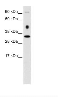EN2 Antibody (C-Terminus)