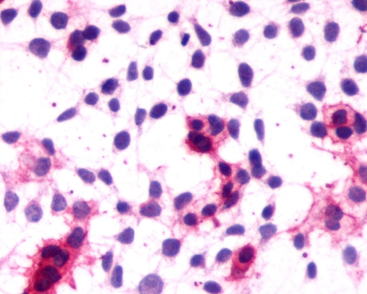 PathPlus™ Polyclonal Rabbit anti-Human CNR1 / CB1 Antibody (C-Terminus, IHC)