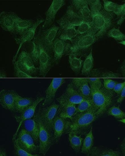 Polyclonal Rabbit anti-Human FRMD6 Antibody (IHC, IF)