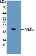 Human IL17RB Protein (Recombinant His, N-Terminal)