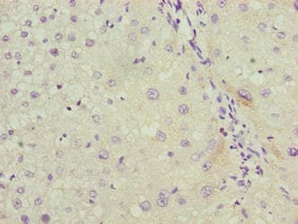 LRG1 / LRG Antibody