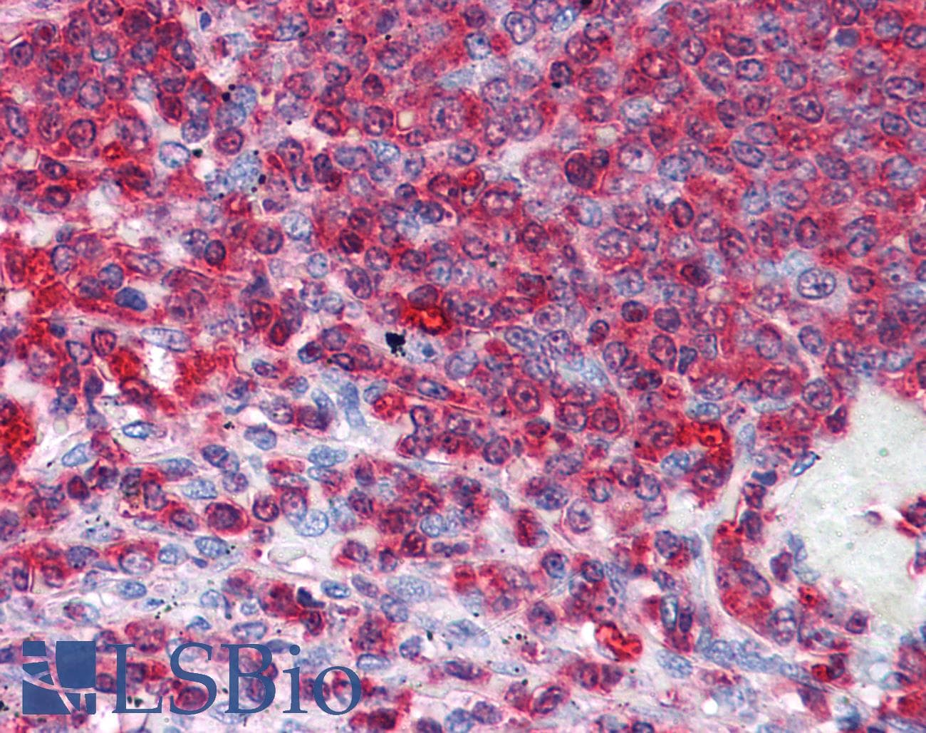 IHC-plus™ GDI2 Antibody