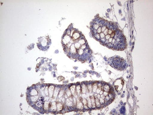 DOCK8 Antibody (aa832-1160, clone OTI4H10)