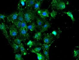 NQO2 Antibody (clone OTI1G2)