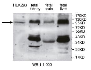 DNMT3A Antibody (aa711-912)