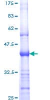 Human ERBB2 / HER2 Protein (Recombinant GST, N-terminus)