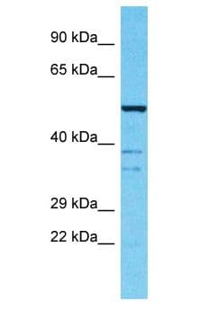 Polyclonal Rabbit anti-Human SPATS2L Antibody (aa40-89, WB)