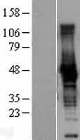 Human CKB / Creatine Kinase BB Protein (Over-Expression Lysate Myc-DDK (Flag))