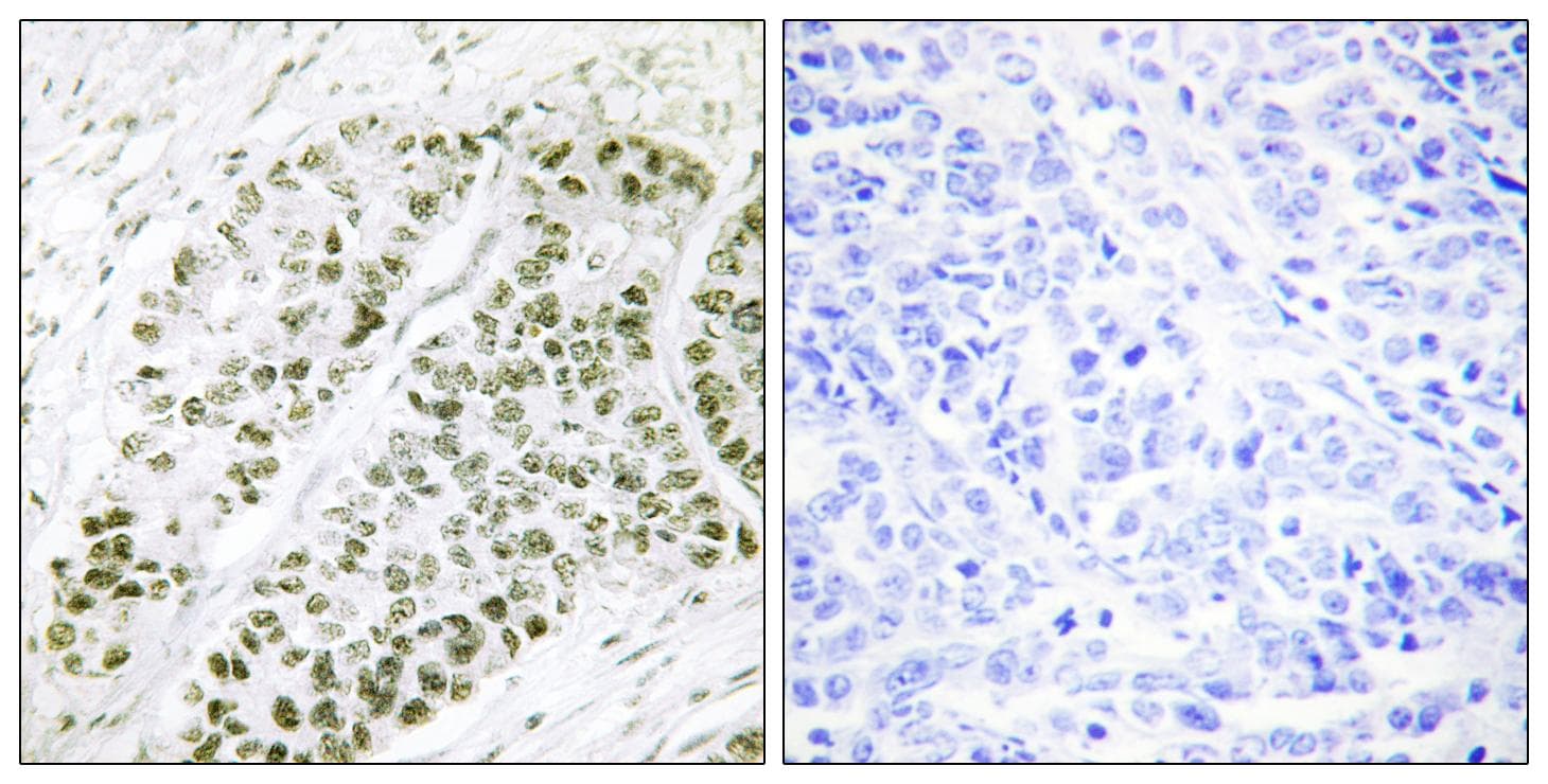 Polyclonal Rabbit anti-Human ATF2 Antibody (phospho-Ser480, IHC, IF, WB)
