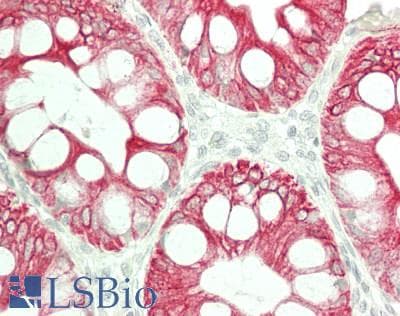 Cytokeratin AE1+AE3 Antibody (clone AE1 & AE3)