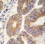 SAHH / AHCY Antibody (aa407-432)