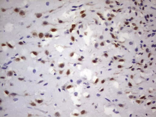 GLI / GLI1 Antibody (aa755-1106, clone OTI4C1)