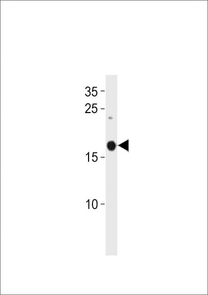 Polyclonal Rabbit anti-Zebrafish SELM / Selenoprotein M Antibody (aa96-119, WB)