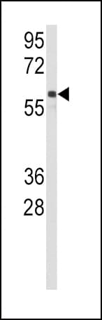 CYP2C9 / Cytochrome P450 2C9 Antibody (aa82-110)