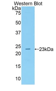 ALOX5 / 5-LOX Antibody (aa223-410)