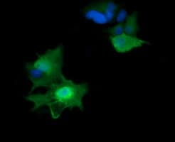 Monoclonal Mouse anti-Human HRAS / H-Ras Antibody (clone OTI1A1, IHC, IF, WB)