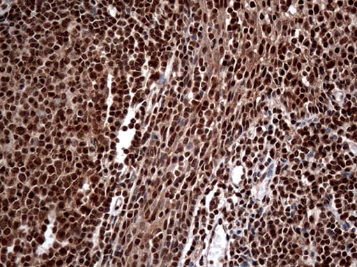 CDK15 / ALS2CR7 Antibody (aa293-378, clone OTI1E1)