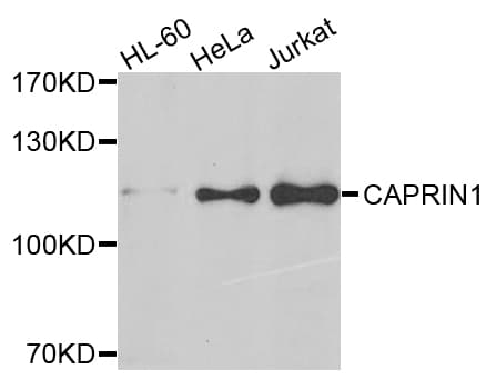 CAPRIN1 Antibody (aa1-300)