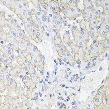 ATP1B1 Antibody