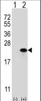 CLDN1 / Claudin 1 Antibody (aa122-163)