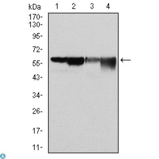 G6PD Antibody