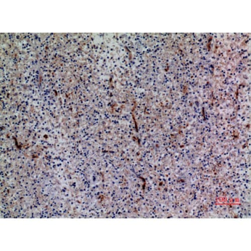 Polyclonal Rabbit anti-Human CXCR6 Antibody (1-50 aa, N-terminal, IHC, WB)