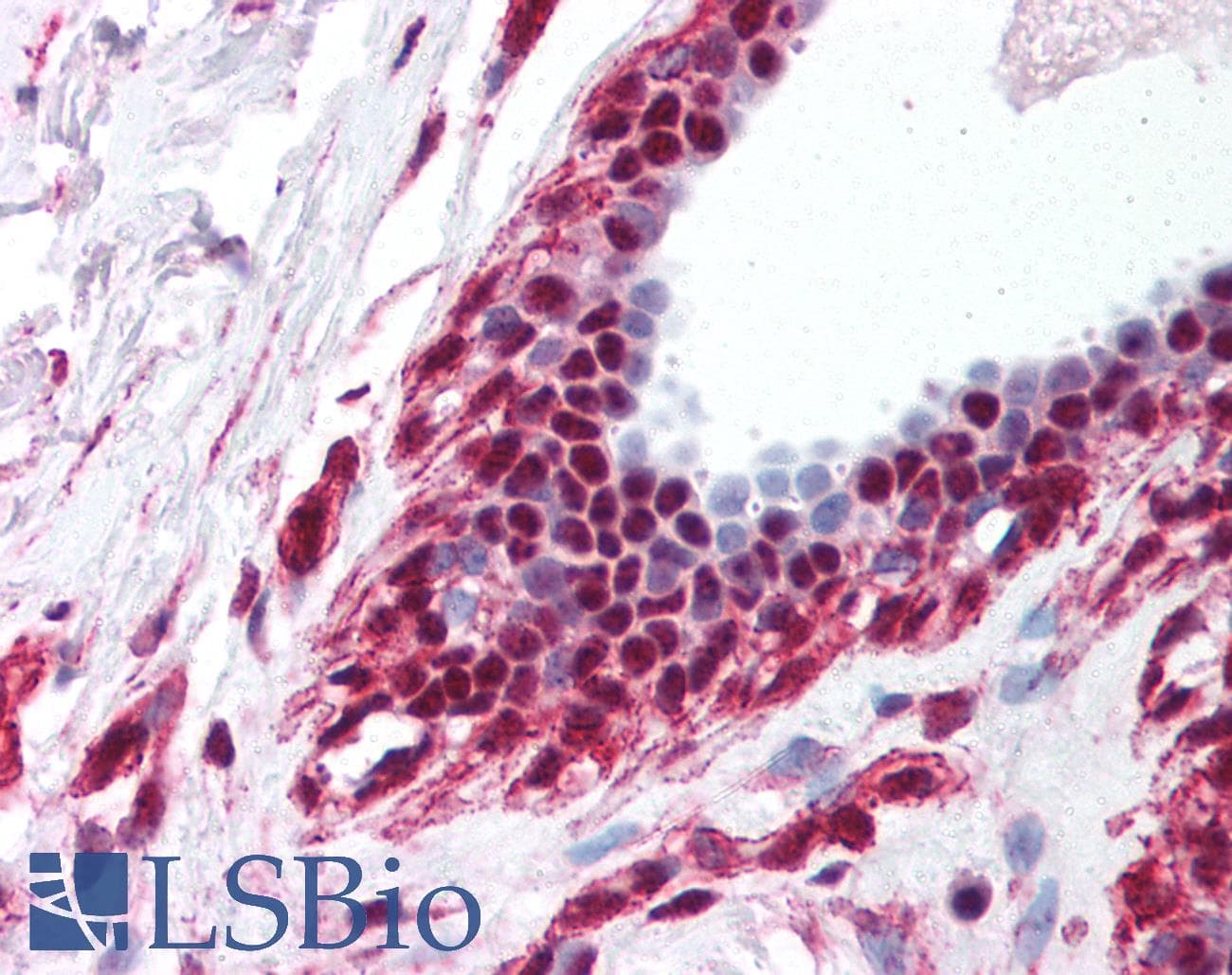 Polyclonal Rabbit anti-Human DDX39B / UAP56 Antibody (C-Terminus, IHC, WB)