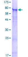 Human POC1B / WDR51B Protein (Recombinant GST)