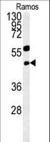 PHGDH Antibody (aa249-277)