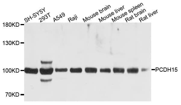 Polyclonal Rabbit anti-Human PCDH15 Antibody (WB)