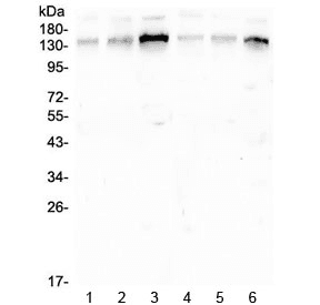 Polyclonal Rabbit anti-Human GOLGA2 / GM130 Antibody (IHC, WB)