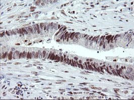TRMT2A Antibody (clone OTI1H8, Carrier-free)