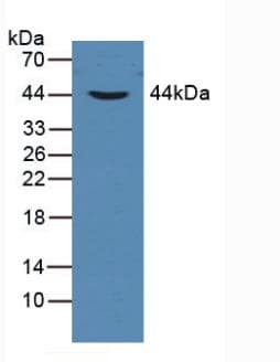 CYFRA21-1 Antibody
