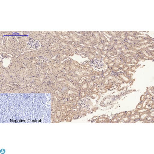 Polyclonal Rabbit anti-Human APP / Beta Amyloid Precursor Antibody (WB)