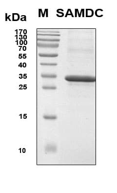 Human AMD / AMD1 Protein (Recombinant 6His, N-terminus)