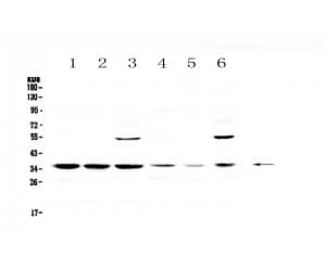 AP-1 / JUND Antibody
