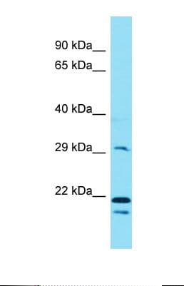 Polyclonal Rabbit anti-Human EEF2KMT / FAM86A Antibody (C-Terminus, WB)