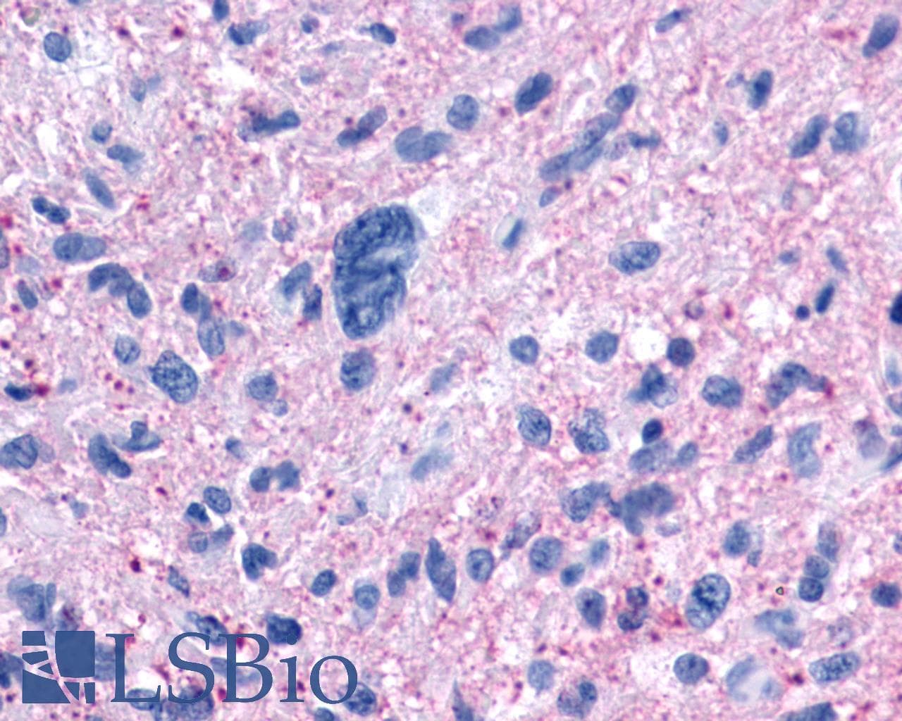 PathPlus™ NPFFR1 / GPR147 Antibody (Extracellular Domain)
