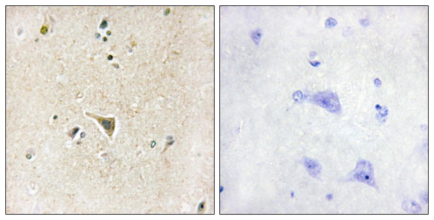 LRRK1 Antibody
