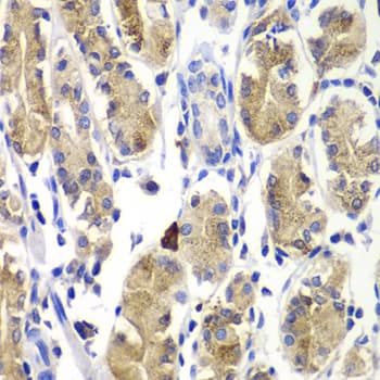 p66 / SHC Antibody