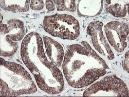 METAP2 Antibody (clone OTI1F6)