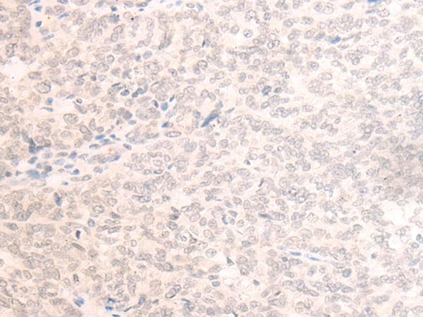 Polyclonal Rabbit anti-Human EME2 Antibody (IHC)