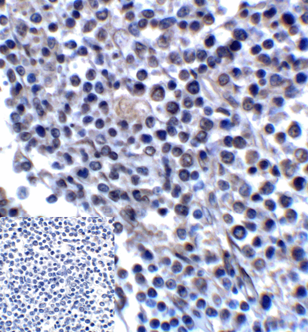CD276 / B7-H3 Antibody (clone 7B3)