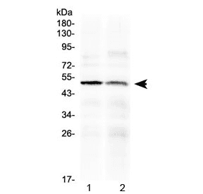 Polyclonal Rabbit anti-Human HTRA3 Antibody (WB)