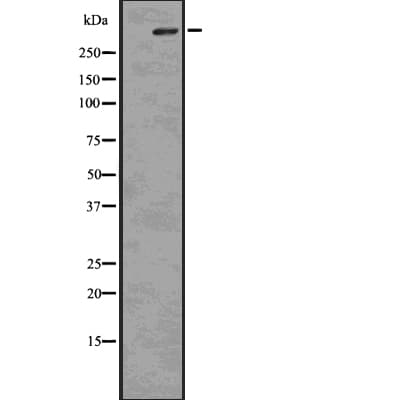 ITPR1 / IP3 Receptor Type 1 Antibody (phospho-Ser1756)